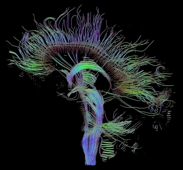 Multi-colored lines representing connectedness among different brain areas in the sagittal view.